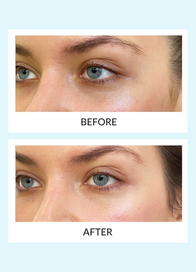Reusable Eye Therapy Patches Solo